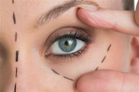 Understanding Blepharoplasty What You Need To Know