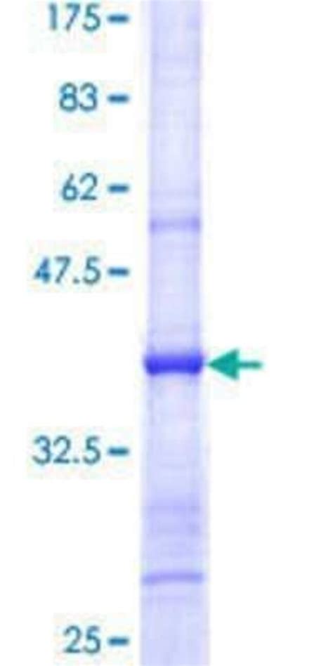 novus biologicals recombinant human eife gst  term protein  mg