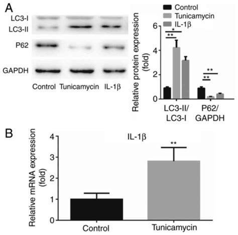 Interleukin‑1β Weakens Paclitaxel Sensitivity Through Regulating