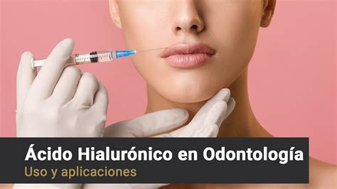 Provenza Cl Nica Dental Cido Hialur Nico En Odontolog A Youtube