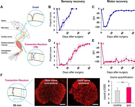 Sensory And Motor Functional Recovery In Two Models Of Peripheral Nerve