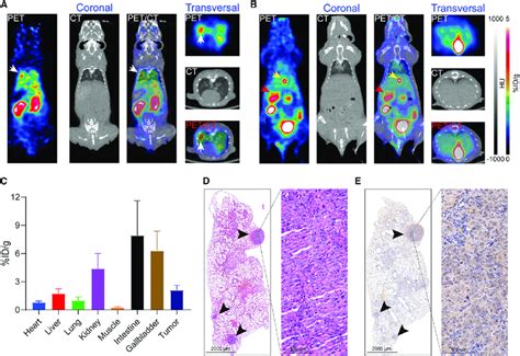 Ff Hu V Immunopet Rapidly Detected Disseminated Cho Cldn