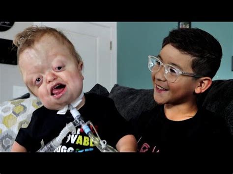 Raedyn's Unique and Fun Life (Pfeiffer Syndrome) - YouTube