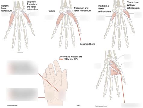 intrinsic muscles of hand - (thenar eminence + adductor pollicis ...