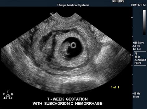 Interpret your ultrasound results for you by Sonographyguru | Fiverr