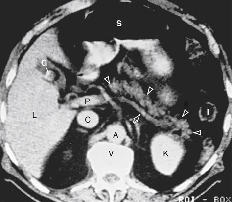 Anatomy Histology Embryology And Developmental Anomalies Of The