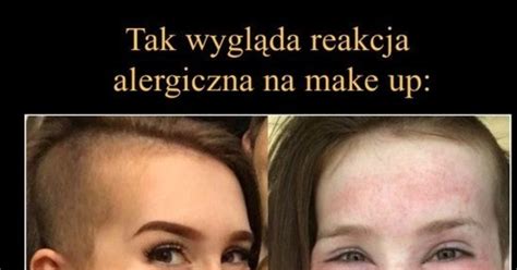 Szamponik Pl Zastanawia A Si Jak Wygl Da Reakcja Alergiczna Na Make