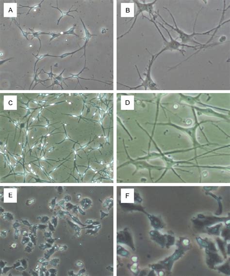 Morphology Of Isolated GNCs Is Similar With Normal Melanocyte A