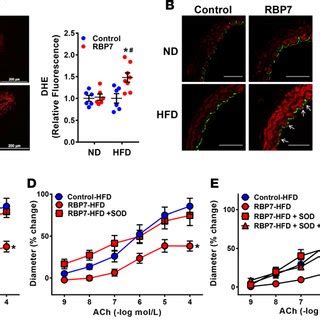 HFD Induced Oxidative Stress A And B Representative Photomicrographs