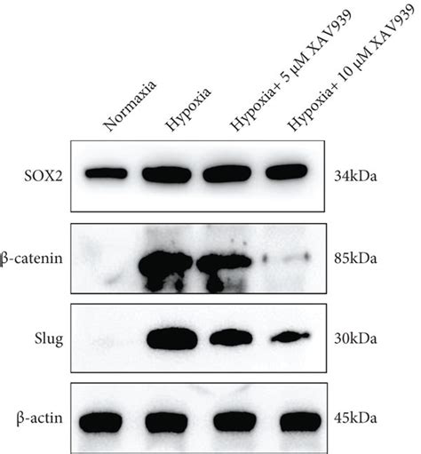 Validation of the Wnt β catenin pathway as a target of SOX2 in HaCaT