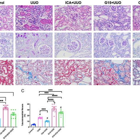 Icariin Treatment Ameliorates Renal Interstitial Fibrosis After UUO A