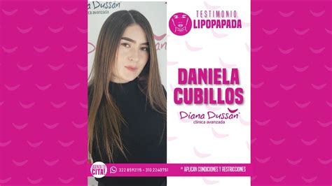 Redujo Su Papapada en Diana Dussan Clínica Avanzada y Estos Fueron