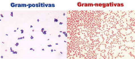 Coloração de Gram Microbiologia e Bioquímica InfoEscola