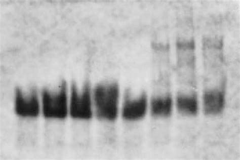 Processing Of 5s Rrna Precursors In The Rne 1 Mutant Cells By Fl And