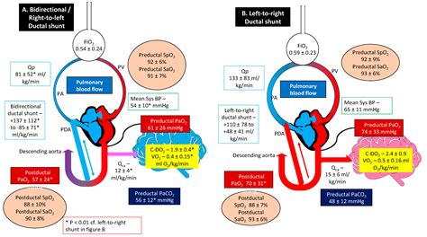 Bidirectional Ductal Shunting And Preductal To Postductal Oxygenation