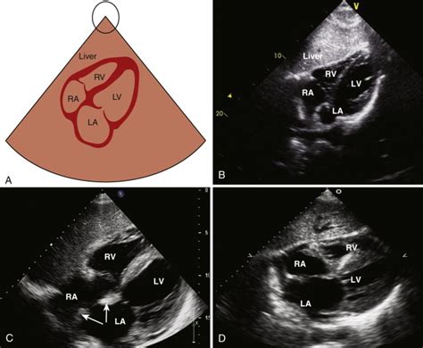 Echocardiography Radiology Key