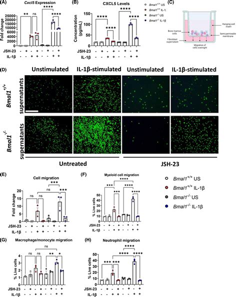 Circadian disruption in lung fibroblasts enhances NFκB activity to