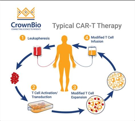 Post FDA Approval: CAR-T Therapy Key Facts