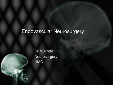 Endovascular Neurosurgery