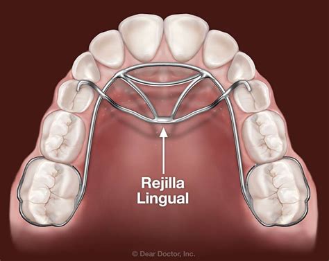 Patient Education Austin Tx Dentist Advanced Smiles Dental P A