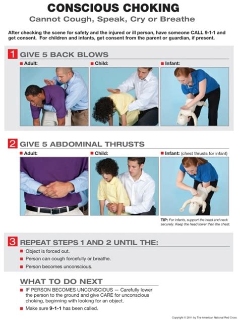 Learning the Heimlich Maneuver: A Life-Saving Skill Everyone Should ...