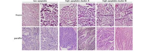 Representative Photomicrographs Of He Stained Tumor Tissues Frozen