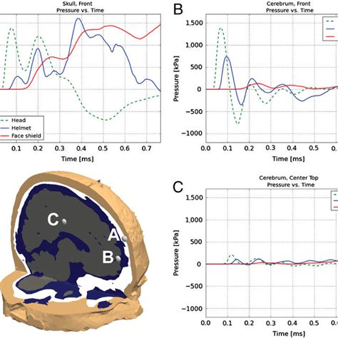 Pressure Profiles From Points In The Cerebrum And Skull For The Head