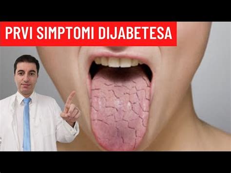 Prvi simptomi ŠEĆERNE BOLESTI! - YouTube