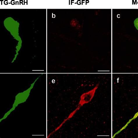 Double Labeling Of The Green Fluorescent Protein Immunofluroscence