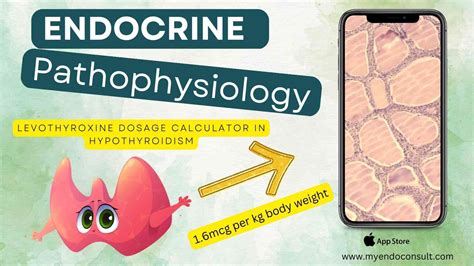 Levothyroxine Dosage Calculator For Hypothyroidism - My Endo Consult