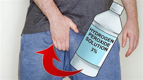 How To Cure Jock Itch With Hydrogen Peroxide Youtube