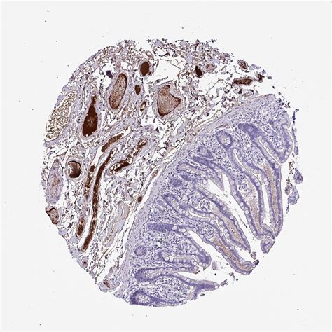 Tissue Expression Of Hp Staining In Colon The Human Protein Atlas