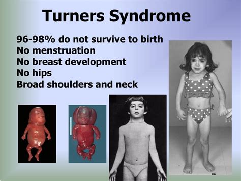 Ppt Chromosomal Mutations And Their Effects Powerpoint Presentation