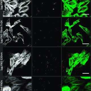 Confocal Images Of HeLa Cells Incubated With FNDs To Visualize