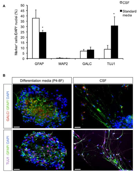 Neurogenesis And Gliogenesis From Adult Human NSCs A The Percentage