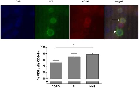 The Expression Of CD247 By Airway CD8 Cells Bronchoalveolar Lavage