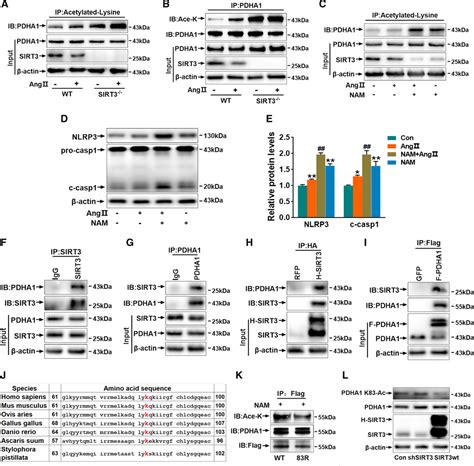 SIRT3 Sirtuin 3 Prevents Ang II Angiotensin II Induced Macrophage