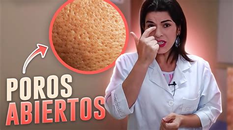 Trucos Efectivos Para Cerrar Los Poros De Forma Natural