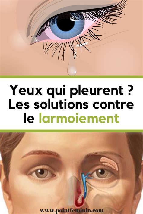 Yeux Qui Pleurent Les Solutions Contre Le Larmoiement Avec Images