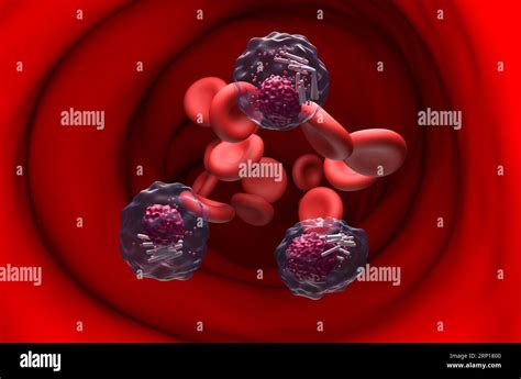 C Lulas De Leucemia Linfoc Tica Cr Nica Llc En El Flujo Sangu Neo