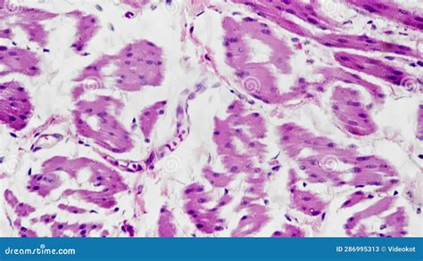 Cross Section Of Human Smooth Muscle Filmed Under Microscope With 400x Magnification Stock Video