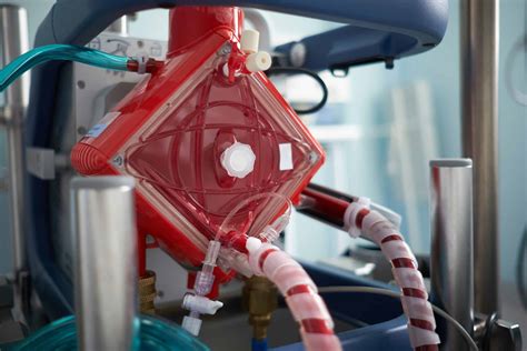 ECMO In The Emergency Department