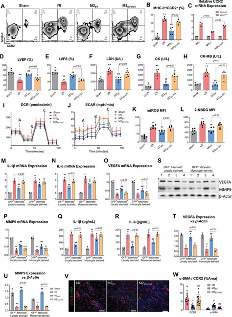 MicroRNA181b5p Is Implicated In CCR2 Regulation By M2EV A Flow