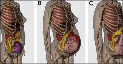 Guess What Happens To Your Internal Organs During Pregnancy Pregnancy Anatomy What Happened