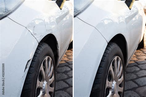 Car Dent Repair Before And After Stock Photo | Adobe Stock