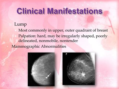 Ppt Breast Cancer Powerpoint Presentation Free Download Id 1448649