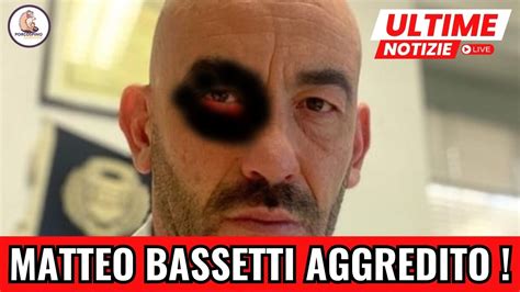 Aggressione Choc A Matteo Bassetti Svelata In Un Video Esclusivo Ma La