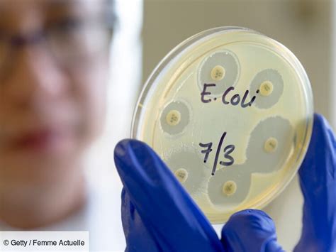 Bactérie E Coli Escherichia coli quels sont les symptômes et que