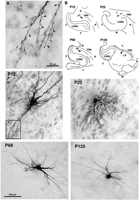 (A) Cells injected during early postnatal life showed complex dendritic ...