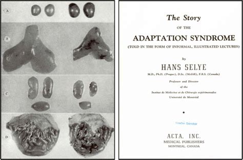 Hans Selye Stress Stages